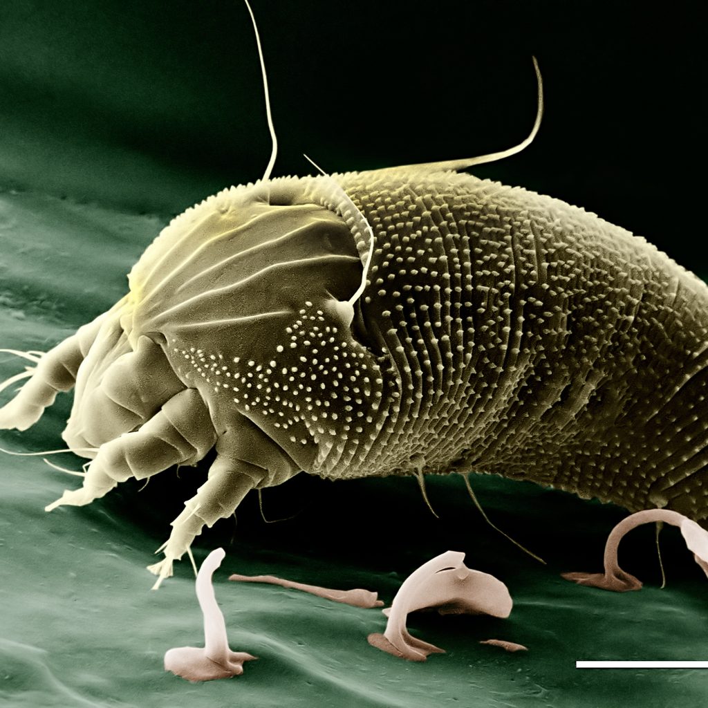 Do I Have Dust Mites? Learn More from Stock Environmental